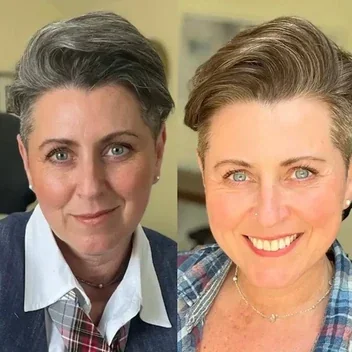 Voor en na resultaat van Caroline T.
